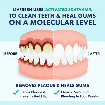 LIVFRESH Gel Toothpaste